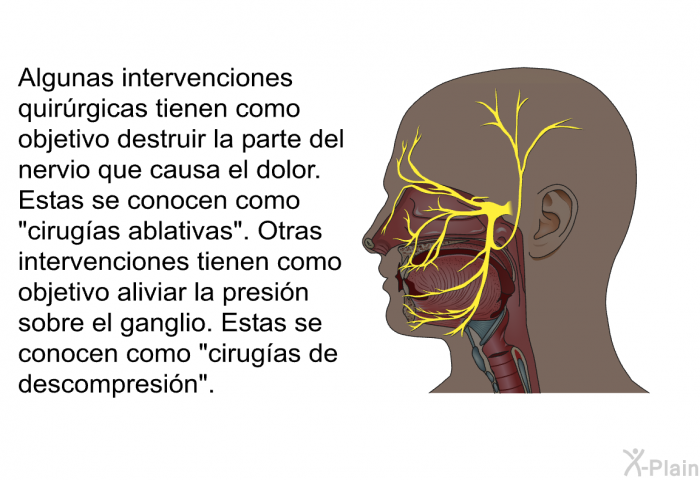 Algunas intervenciones quirrgicas tienen como objetivo destruir la parte del nervio que causa el dolor. Estas se conocen como “cirugas ablativas”. Otras intervenciones tienen como objetivo aliviar la presin sobre el ganglio. Estas se conocen como “cirugas de descompresin”.