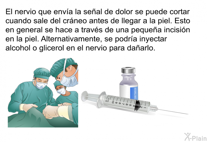 El nervio que enva la seal de dolor se puede cortar cuando sale del crneo antes de llegar a la piel. Esto en general se hace a travs de una pequea incisin en la piel. Alternativamente, se podra inyectar alcohol o glicerol en el nervio para daarlo.