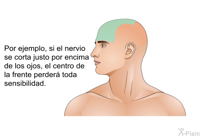 Por ejemplo, si el nervio se corta justo por encima de los ojos, el centro de la frente perder toda sensibilidad.