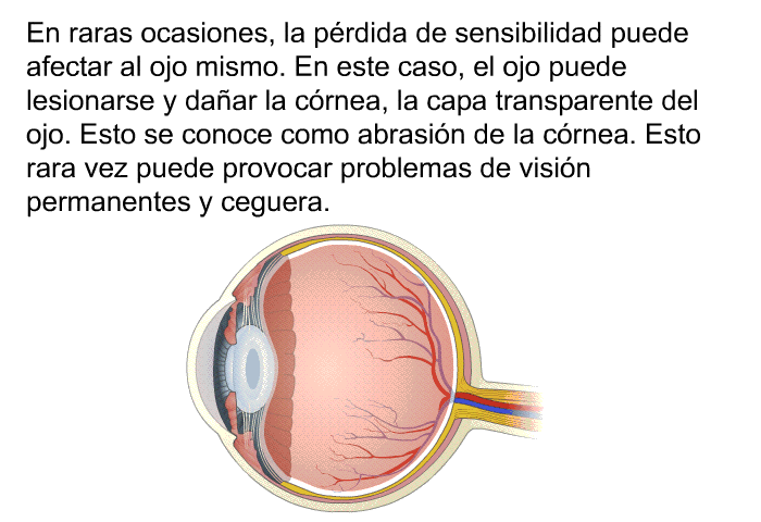 En raras ocasiones, la prdida de sensibilidad puede afectar al ojo mismo. En este caso, el ojo puede lesionarse y daar la crnea, la capa transparente del ojo. Esto se conoce como abrasin de la crnea. Esto rara vez puede provocar problemas de visin permanentes y ceguera.
