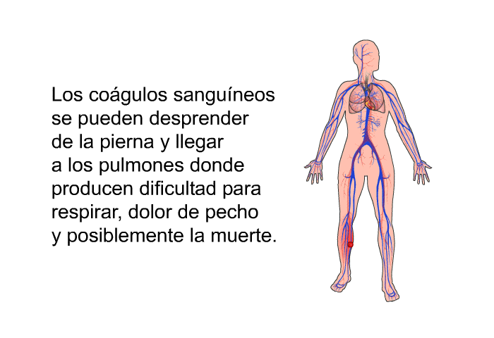 Los cogulos sanguneos se pueden desprender de la pierna y llegar a los pulmones donde producen dificultad para respirar, dolor de pecho y posiblemente la muerte.