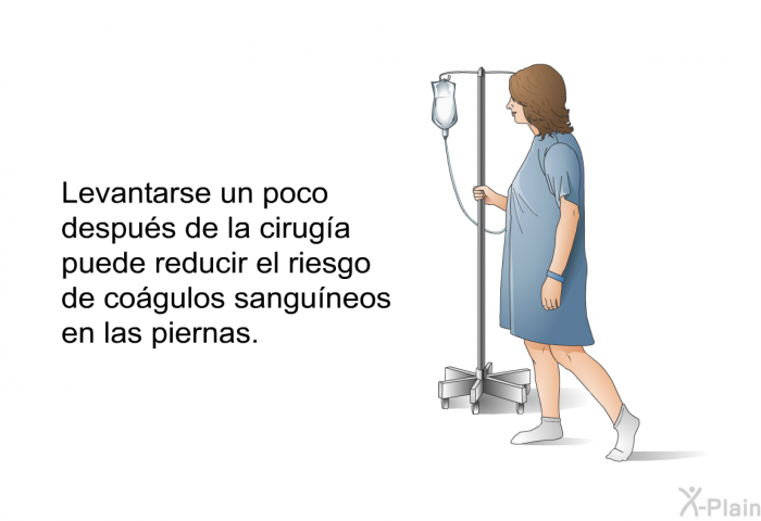 Levantarse un poco despus de la ciruga puede reducir el riesgo de cogulos sanguneos en las piernas.
