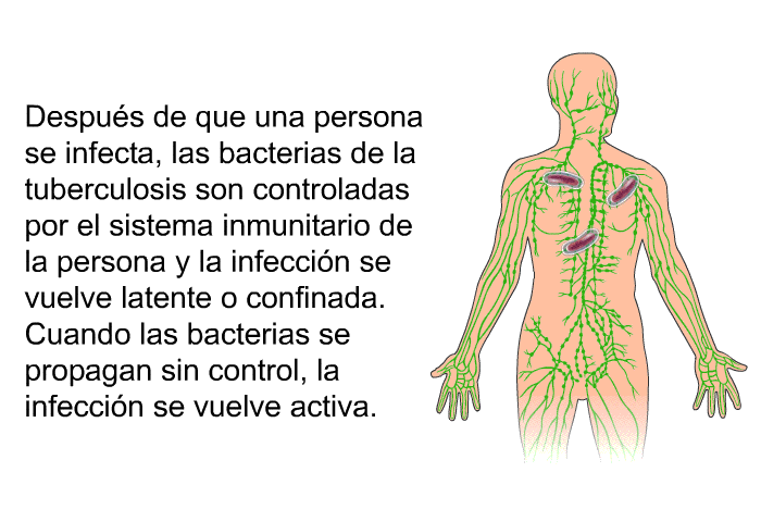 Despus de que una persona se infecta, las bacterias de la tuberculosis son controladas por el sistema inmunitario de la persona y la infeccin se vuelve latente o confinada. Cuando las bacterias se propagan sin control, la infeccin se vuelve activa.