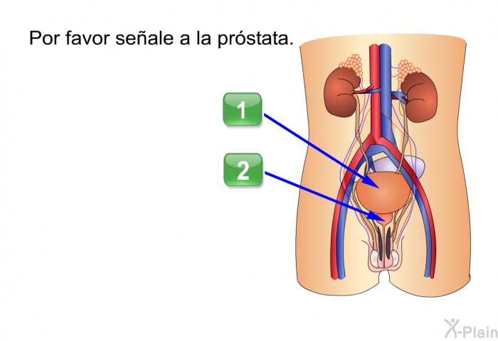 Por favor seale a la prstata.