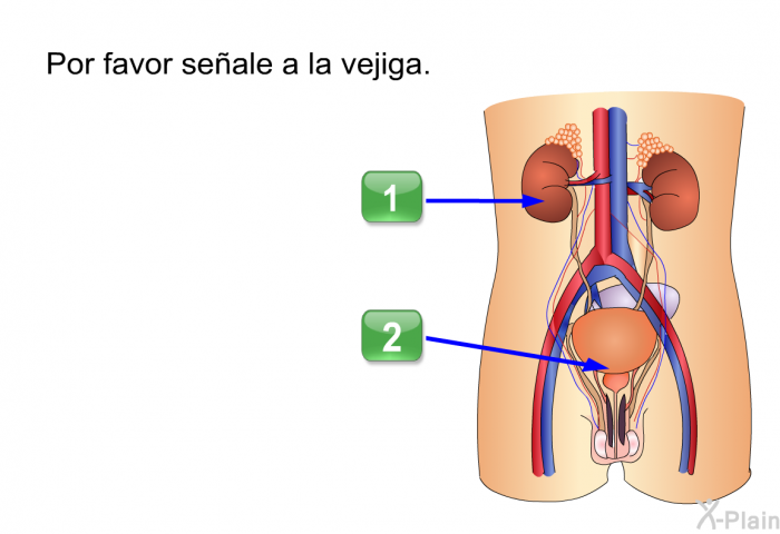 Por favor seale a la vejiga.