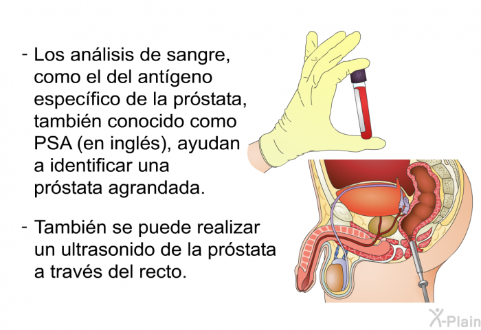 Los anlisis de sangre, como el del antgeno especfico de la prstata, tambin conocido como PSA (en ingls), ayudan a identificar una prstata agrandada. Tambin se puede realizar un ultrasonido de la prstata a travs del recto.