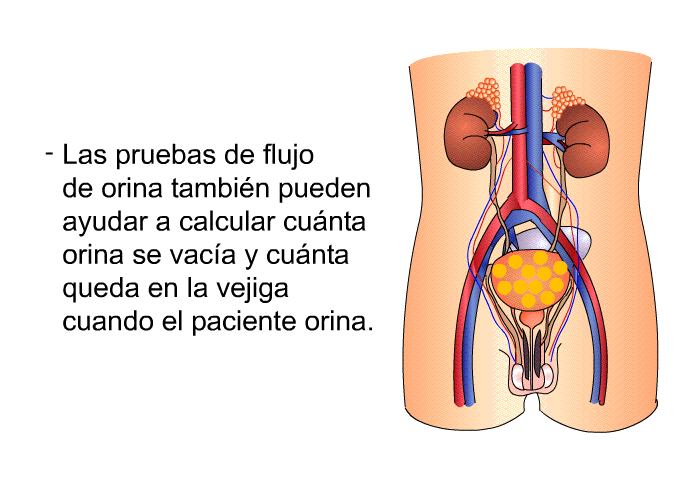 Las pruebas de flujo de orina tambin pueden ayudar a calcular cunta orina se vaca y cunta queda en la vejiga cuando el paciente orina.