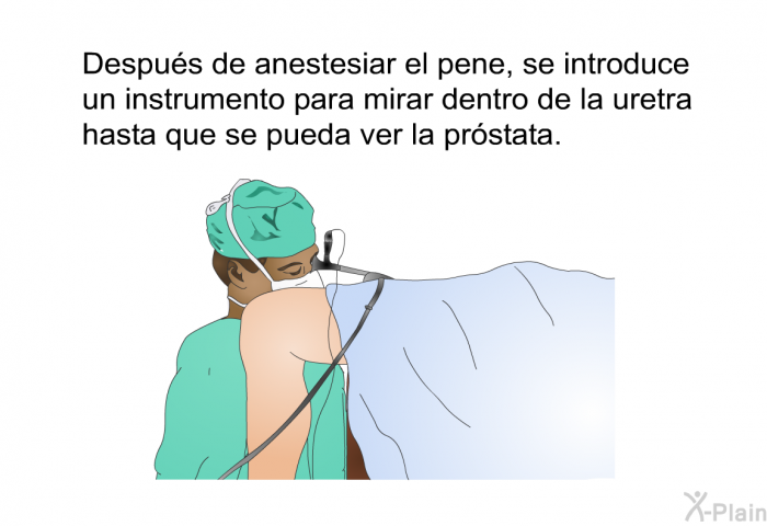 Despus de anestesiar el pene, se introduce un instrumento para mirar dentro de la uretra hasta que se pueda ver la prstata.