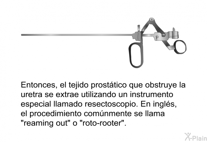 Entonces, el tejido prosttico que obstruye la uretra se extrae utilizando un instrumento especial llamado resectoscopio. En ingls, el procedimiento comnmente se llama “reaming out” o “roto-rooter”.