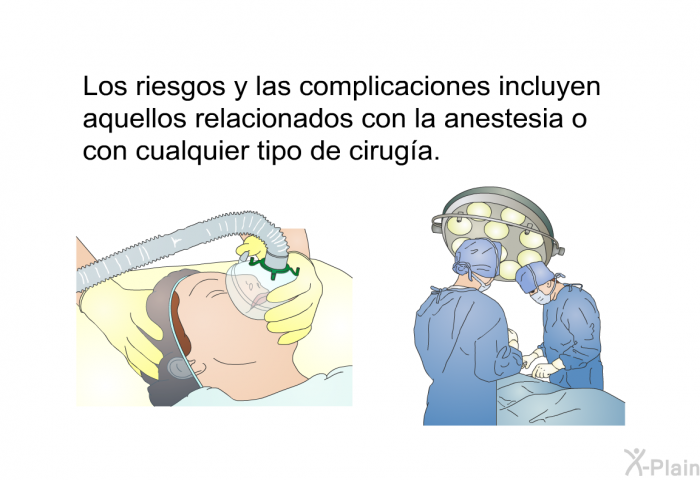 Los riesgos y las complicaciones incluyen aquellos relacionados con la anestesia o con cualquier tipo de ciruga.