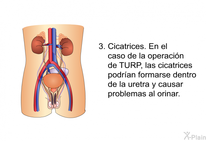 Cicatrices. En el caso de la operacin de TURP, las cicatrices podran formarse dentro de la uretra y causar problemas al orinar.