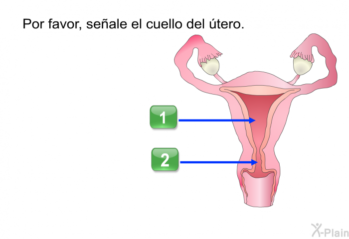 Por favor, seale el cuello del tero.