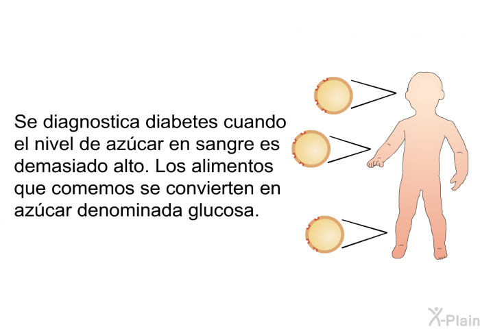 Se diagnostica diabetes cuando el nivel de azcar en sangre es demasiado alto. Los alimentos que comemos se convierten en azcar denominada glucosa.