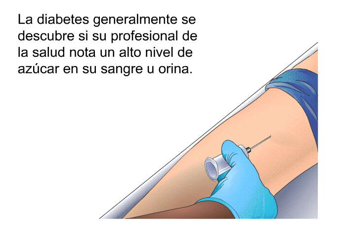 La diabetes generalmente se descubre si su profesional de la salud nota un alto nivel de azcar en su sangre u orina.