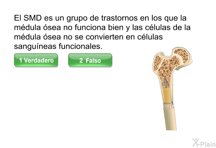 El SMD es un grupo de trastornos en los que la mdula sea no funciona bien y las clulas de la mdula sea no se convierten en clulas sanguneas funcionales.