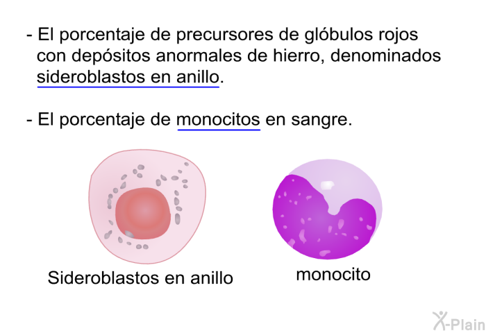 El porcentaje de precursores de glbulos rojos con depsitos anormales de hierro, denominados sideroblastos en anillo. El porcentaje de monocitos en sangre.