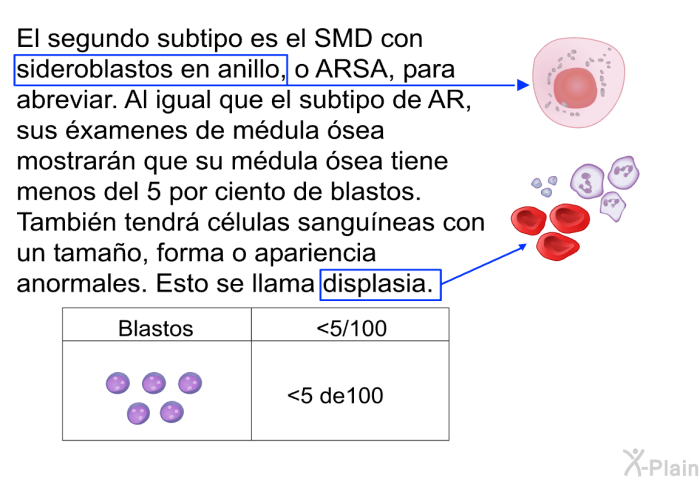 El segundo subtipo es el SMD con sideroblastos en anillo, o ARSA, para abreviar. Al igual que el subtipo de AR, sus �xamenes de m�dula �sea mostrar�n que su m�dula �sea tiene menos del 5 por ciento de blastos. Tambi�n tendr� c�lulas sangu�neas con un tama�o, forma o apariencia anormales. Esto se llama displasia.