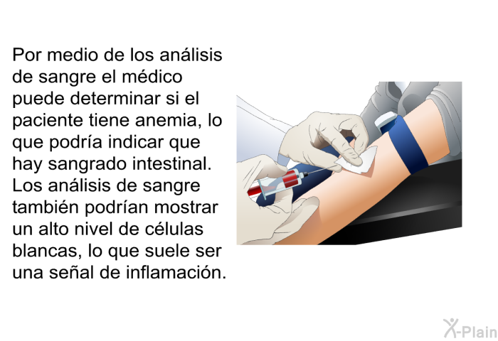Por medio de los anlisis de sangre el mdico puede determinar si el paciente tiene anemia, lo que podra indicar que hay sangrado intestinal. Los anlisis de sangre tambin podran mostrar un alto nivel de clulas blancas, lo que suele ser una seal de inflamacin.