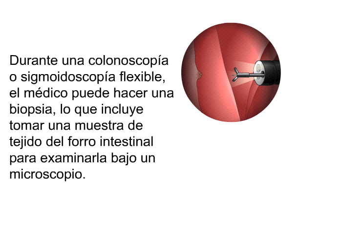 Durante una colonoscopa o sigmoidoscopa flexible, el mdico puede hacer una biopsia, lo que incluye tomar una muestra de tejido del forro intestinal para examinarla bajo un microscopio.
