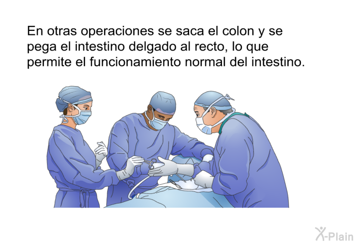 En otras operaciones se saca el colon y se pega el intestino delgado al recto, lo que permite el funcionamiento normal del intestino.