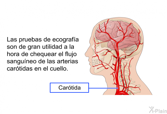 Las pruebas de ecograf�a son de gran utilidad a la hora de chequear el flujo sangu�neo de las arterias car�tidas en el cuello.