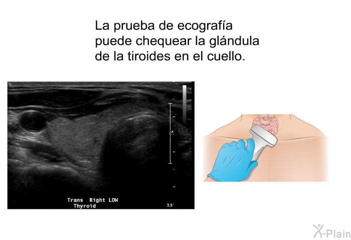 La prueba de ecografa puede chequear la glndula de la tiroides en el cuello.