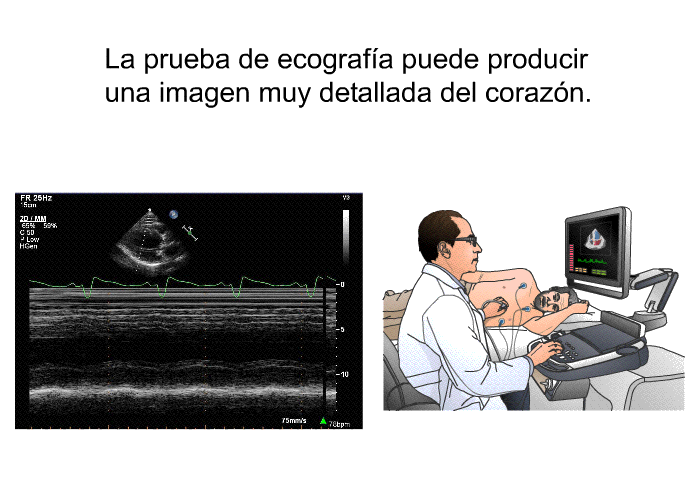 La prueba de ecografa puede producir una imagen muy detallada del corazn.