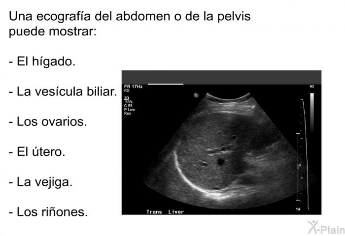 Una ecografa del abdomen o de la pelvis puede mostrar:  El hgado. La vescula biliar. Los ovarios. El tero. La vejiga. Los riones.