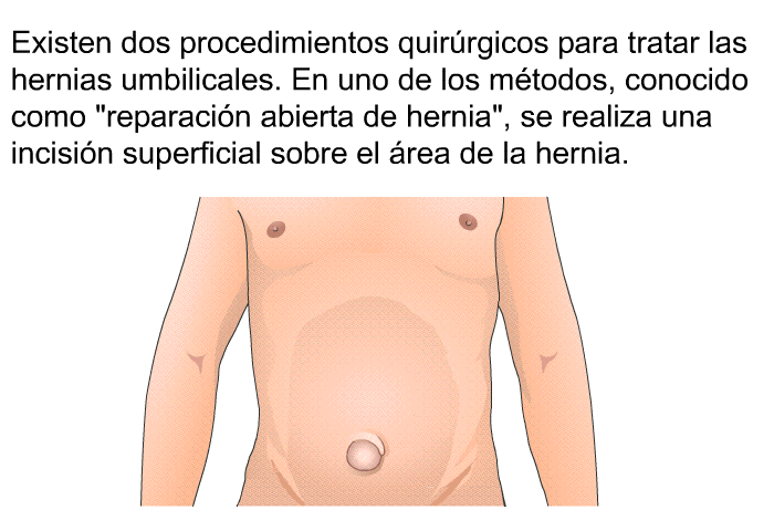 Existen dos procedimientos quir�rgicos para tratar las hernias umbilicales. En uno de los m�todos, conocido como &ldquo;reparaci�n abierta de hernia&rdquo;, se realiza una incisi�n superficial sobre el �rea de la hernia.