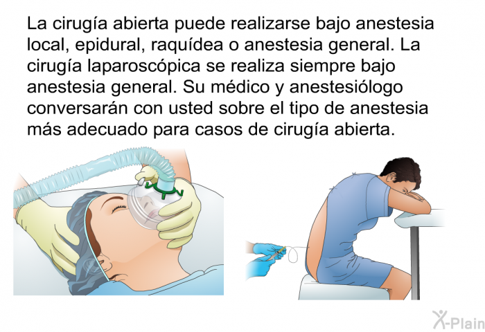 La cirug�a abierta puede realizarse bajo anestesia local, epidural, raqu�dea o anestesia general. La cirug�a laparosc�pica se realiza siempre bajo anestesia general.&nbsp;Su m�dico y anestesi�logo conversar�n con usted sobre el tipo de anestesia m�s adecuado para casos de cirug�a abierta.