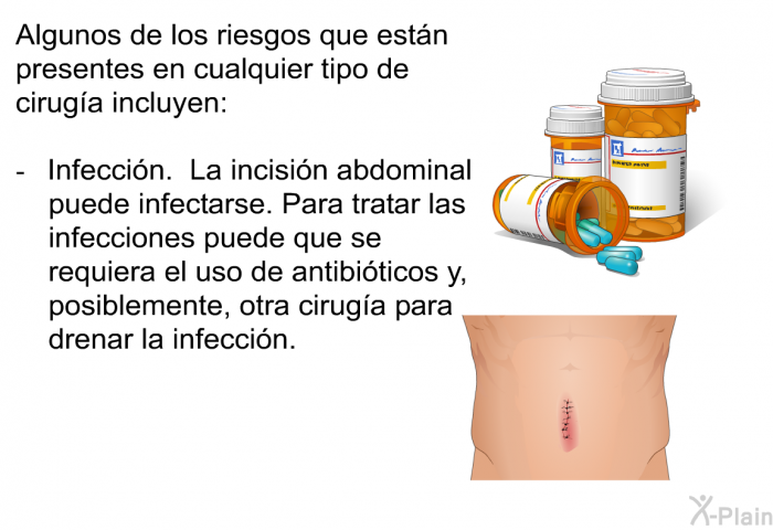 Algunos de los riesgos que est�n presentes en cualquier tipo de cirug�a incluyen:  Infecci�n. La incisi�n abdominal puede infectarse. Para tratar las infecciones puede que se requiera el uso de antibi�ticos y, posiblemente, otra cirug�a para drenar la infecci�n.
