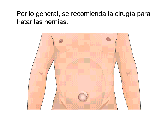 Por lo general, se recomienda la cirug�a para tratar las hernias.