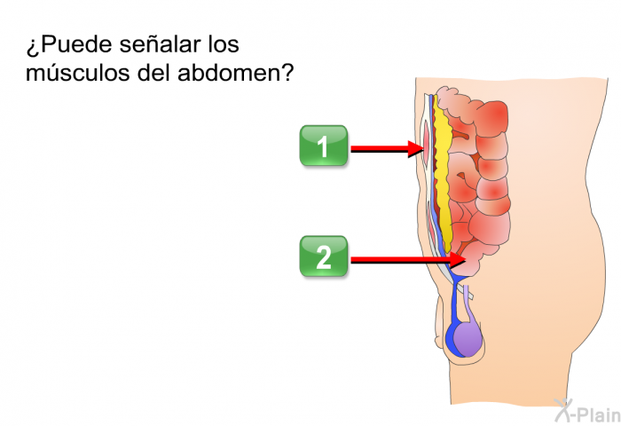 ¿Puede sealar los msculos del abdomen? <I>Seleccione A o B.</I>