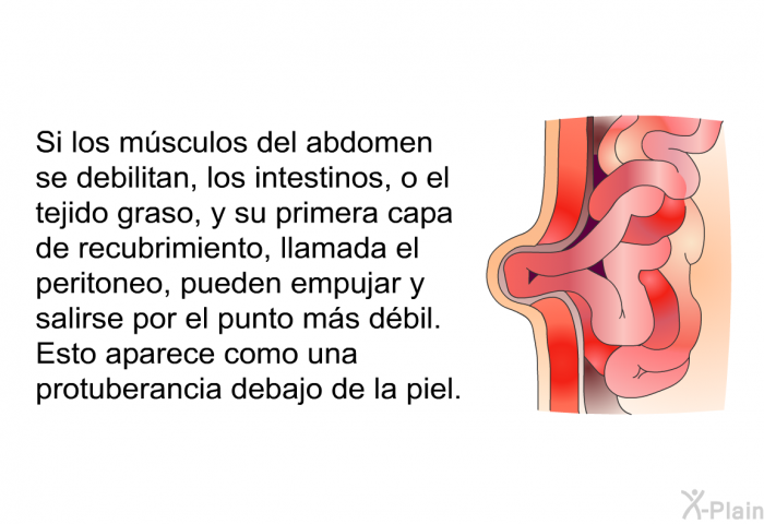 Si los msculos del abdomen se debilitan, los intestinos, o el tejido graso, y su primera capa de recubrimiento, llamada el peritoneo, pueden empujar y salirse por el punto ms dbil. Esto aparece como una protuberancia debajo de la piel.
