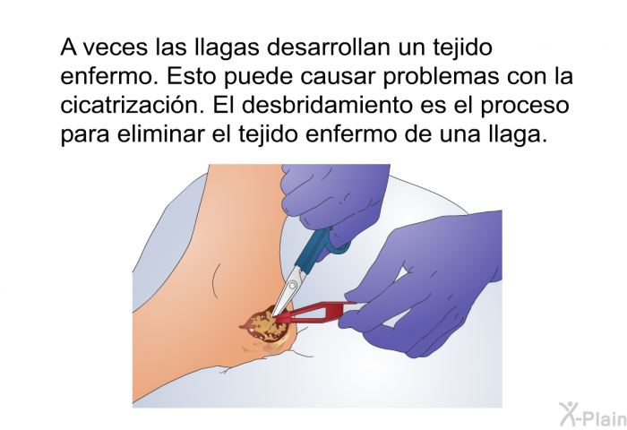 A veces las llagas desarrollan un tejido enfermo. Esto puede causar problemas con la cicatrizacin. El desbridamiento es el proceso para eliminar el tejido enfermo de una llaga.