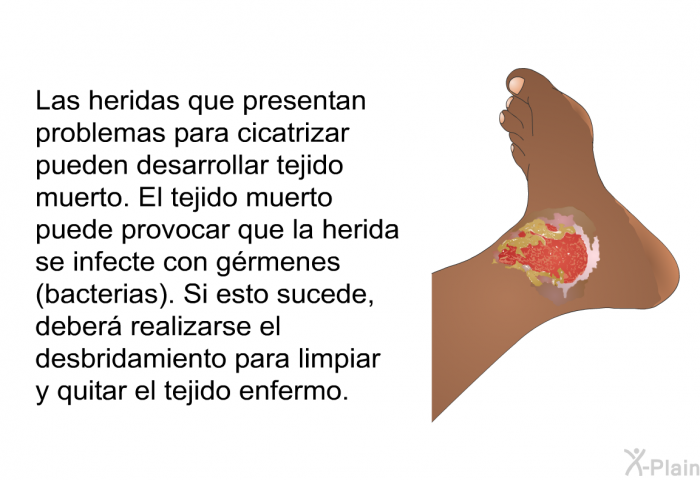 Las heridas que presentan problemas para cicatrizar pueden desarrollar tejido muerto. El tejido muerto puede provocar que la herida se infecte con grmenes (bacterias). Si esto sucede, deber realizarse el desbridamiento para limpiar y quitar el tejido enfermo.