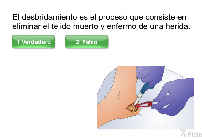 El desbridamiento es el proceso que consiste en eliminar el tejido muerto y enfermo de una herida.