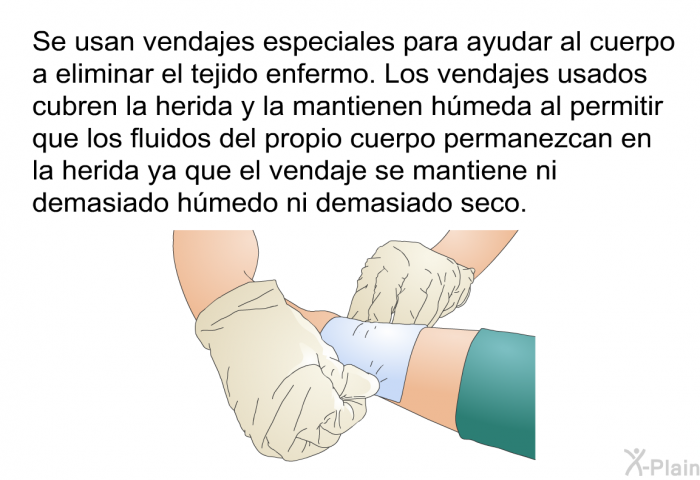 Se usan vendajes especiales para ayudar al cuerpo a eliminar el tejido enfermo. Los vendajes usados cubren la herida y la mantienen hmeda al permitir que los fluidos del propio cuerpo permanezcan en la herida ya que el vendaje se mantiene ni demasiado hmedo ni demasiado seco.