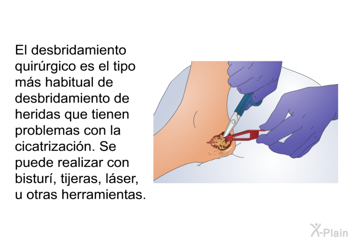El desbridamiento quirrgico es el tipo ms habitual de desbridamiento de heridas que tienen problemas con la cicatrizacin. Se puede realizar con bistur, tijeras, lser, u otras herramientas.