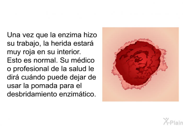 Una vez que la enzima hizo su trabajo, la herida estar muy roja en su interior. Esto es normal. Su mdico o profesional de la salud le dir cundo puede dejar de usar la pomada para el desbridamiento enzimtico.