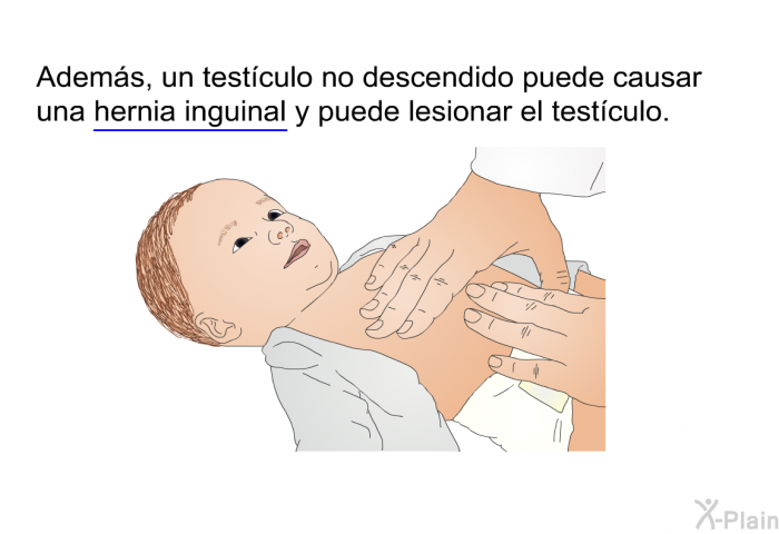 Adems, un testculo no descendido puede causar una hernia inguinal y puede lesionar el testculo.