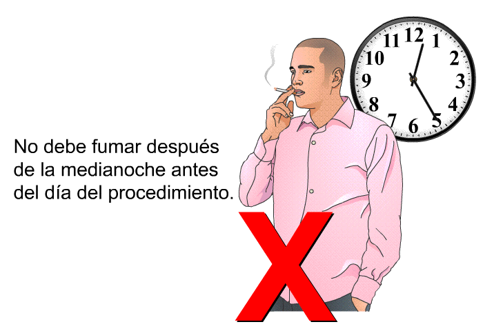 No debe fumar despu�s de la medianoche antes del d�a del procedimiento.