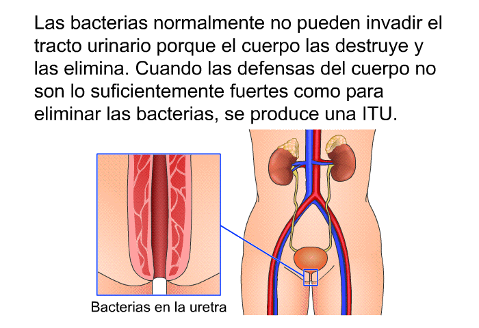 Las bacterias normalmente no pueden invadir el tracto urinario porque el cuerpo las destruye y las elimina. Cuando las defensas del cuerpo no son lo suficientemente fuertes como para eliminar las bacterias, se produce una ITU.