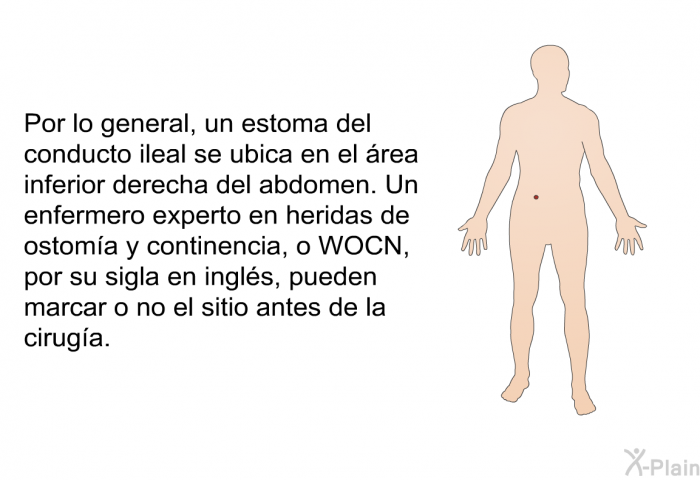 Por lo general, un estoma del conducto ileal se ubica en el rea inferior derecha del abdomen. Un enfermero experto en heridas de ostoma y continencia, o WOCN, por su sigla en ingls, pueden marcar o no el sitio antes de la ciruga.