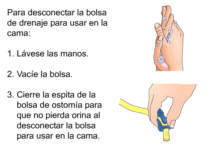 Para desconectar la bolsa de drenaje para usar en la cama:  Lvese las manos. Vace la bolsa. Cierre la espita de la bolsa de ostoma para que no pierda orina al desconectar la bolsa para usar en la cama.