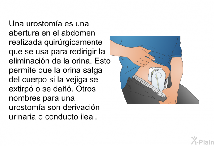 Una urostoma es una abertura en el abdomen realizada quirrgicamente que se usa para redirigir la eliminacin de la orina. Esto permite que la orina salga del cuerpo si la vejiga se extirp o se da. Otros nombres para una urostoma son derivacin urinaria o conducto ileal.