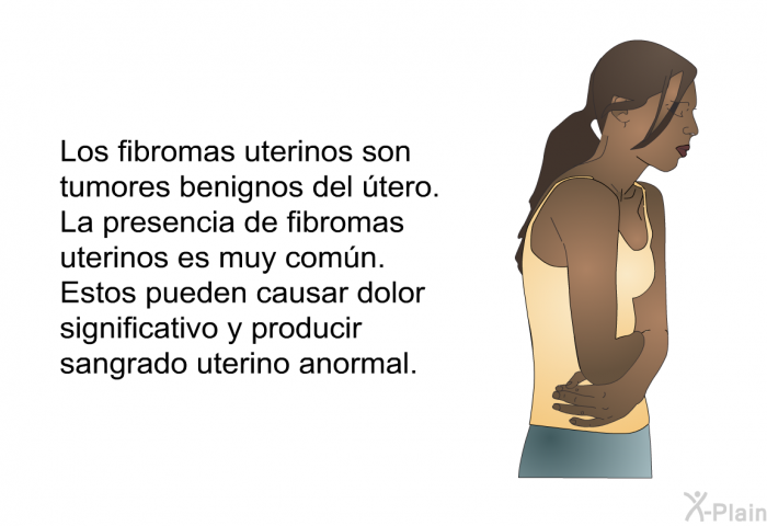 Los fibromas uterinos son tumores benignos del tero. La presencia de fibromas uterinos es muy comn. Estos pueden causar dolor significativo y producir sangrado uterino anormal.