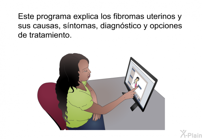 Esta informacin acerca de su salud explica los fibromas uterinos y sus causas, sntomas, diagnstico y opciones de tratamiento.