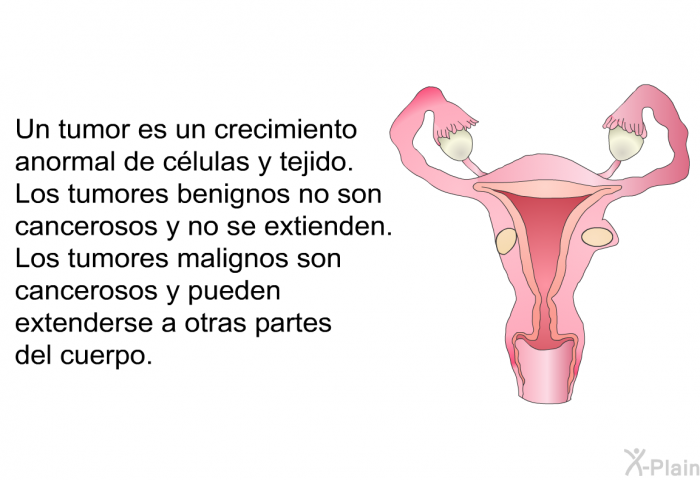 Un tumor es un crecimiento anormal de clulas y tejido. Los tumores benignos no son cancerosos y no se extienden. Los tumores malignos son cancerosos y pueden extenderse a otras partes del cuerpo.