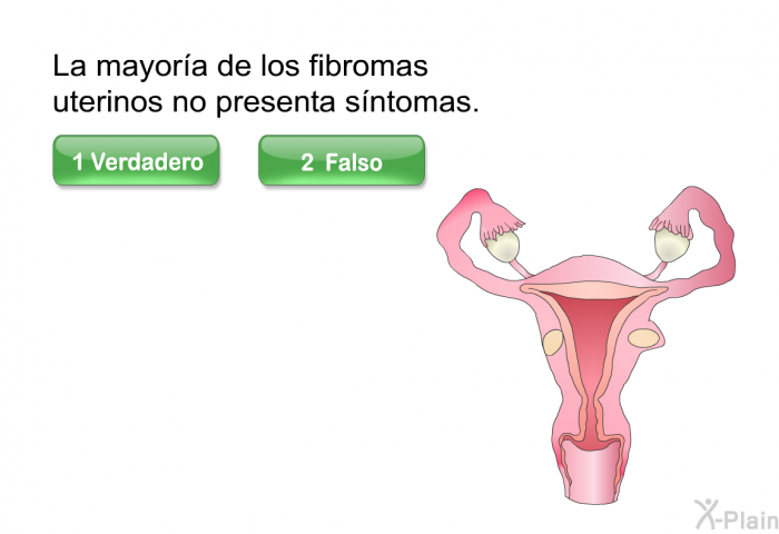 La mayora de los fibromas uterinos no presenta sntomas.